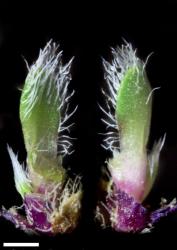 Veronica pulvinaris. Leaf surfaces, adaxial (left) and abaxial (right). Scale = 1 mm.
 Image: P.J. Garnock-Jones © Te Papa CC-BY-NC 3.0 NZ